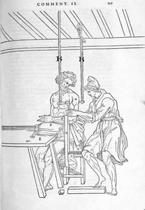 Réduction des fractures. Planche illustrée de « De dissectione partium corporis humani libri tres... » par Carlo Stefano Riverio, Paris 1545.