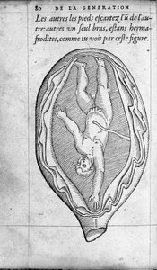 La position du fœtus dans l