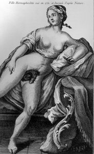 Fille hermaphrodite vue en 1751 et dessinée d