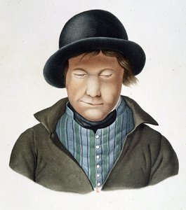 Lépreux d