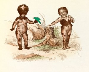 Petite fille couverte de taches de poils (gravure) - Unknown artist