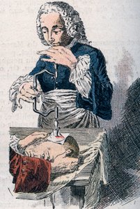 La trépanation. Estampe du 18ème siècle - Unknown artist