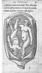 Position du fœtus dans l