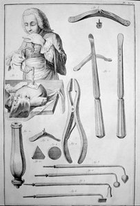 Trépanation du crâne, divers instruments (gravure)