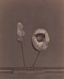 Articulation du genou excisée. Une balle de mousquet ronde dans le condyle interne du fémur droit - William H. Bell