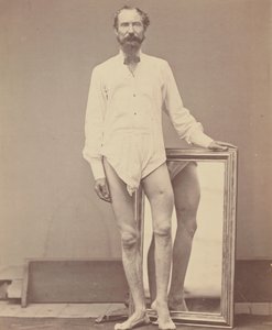 Blessure par balle du tiers moyen du fémur gauche - William H. Bell