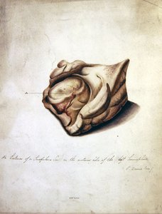 Étude du cerveau II, vers 1850 - William Lover