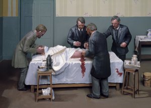 Antiseptiques chirurgicaux Une opération antiseptique