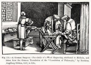 Un chirurgien allemand, de Consolation de Philosophie par Boèce, illustration de Science et Littérature au Moyen Âge et à la Renaissance, écrit et gravé par Paul Lacroix, 1878 - after German School