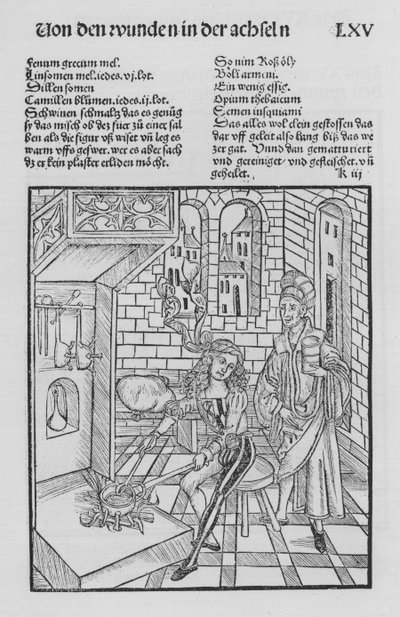 Le Livre de Chirurgie par Hieronymus Brunschwig - (after) German School