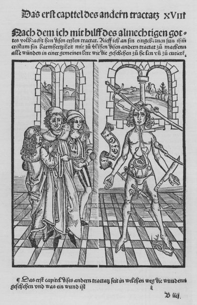 Le livre de Cirurgia par Hieronymus Brunschwig - (after) German School