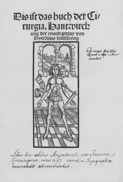 Le Livre de Cirurgia par Hieronymus Brunschwig - (after) German School