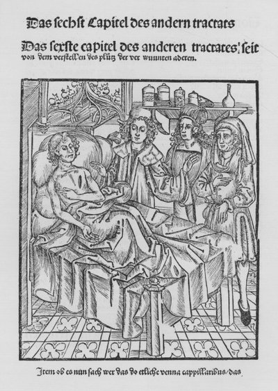 Le livre de Cirurgia par Hieronymus Brunschwig - (after) German School