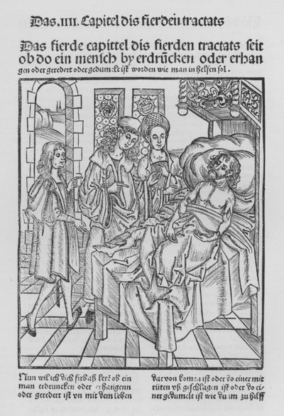 Le Livre de Cirurgia par Hieronymus Brunschwig - (after) German School