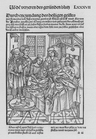 Le Livre de Cirurgia par Hieronymus Brunschwig (lithographie) - (after) German School