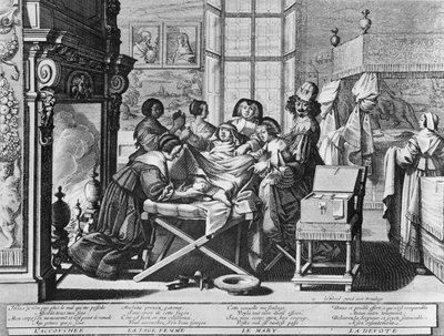 Série de gravures (eau-forte) intitulée « Le Mariage à la Ville » de 1633 par Abraham Bosse - « Accouchement » : sur le lit de travail - Abraham Bosse