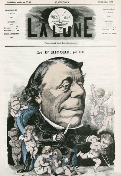 Portrait du Docteur Ricord, médecin français. Caricature par Gill, dans "La Lune", 20 octobre - Andre Gill