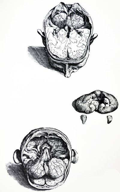 Les planches du septième livre de De Humani Corporis Fabrica - Andreas Vesalius