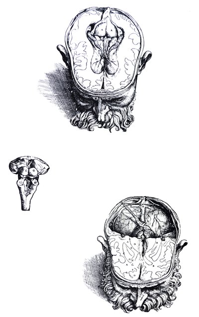 Les planches du septième livre de De Humani Corporis Fabrica - Andreas Vesalius