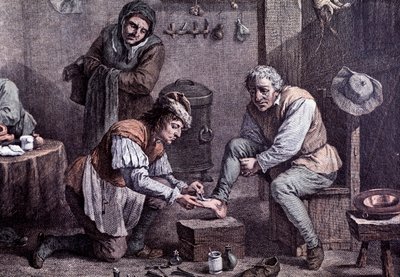 Une opération chirurgicale (gravure) - Anonymous Anonymous