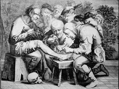 Chirurgie de la cheville (gravure) - Anonymous Anonymous