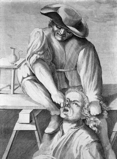 Le tireur de dents (gravure, 18e siècle) - Anonymous Anonymous