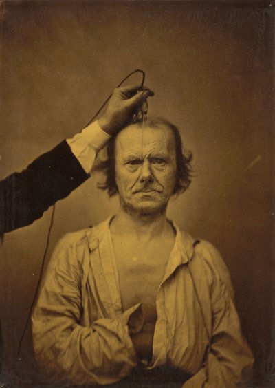 Attention à gauche, Sévérité, agression à droite, 1854-1856, imprimé 1862 - Duchenne de Boulogne