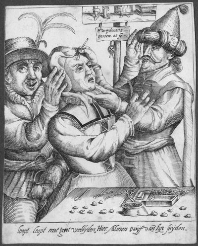 Trépanation, gravé par H. Weydmans (16ème siècle) - Dutch School