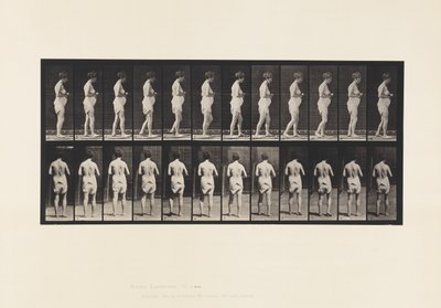 Planche 542. Sclérose cérébro-spinale multiple - Marche - Eadweard Muybridge