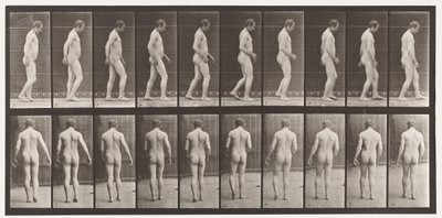 Planche 553. Après traumatisme crânien ; marche - Eadweard Muybridge