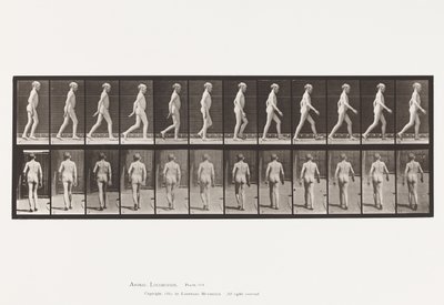 Planche 562. Courbure Latérale de la Colonne Vertébrale; Marche - Eadweard Muybridge