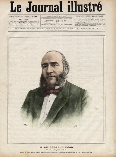 Portrait de Jules Émile (Jules-Émile) Péan (1830-1898), chirurgien français - Gravure de Navellier dans « Le Journal Illustré » de 1892 - Edouard Felicien Eugene Navellier