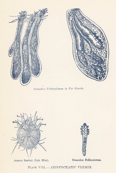 La vermine aristocratique (lithographie couleur) - English School