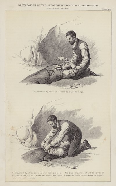 Restauration des noyés ou asphyxiés apparents - English School