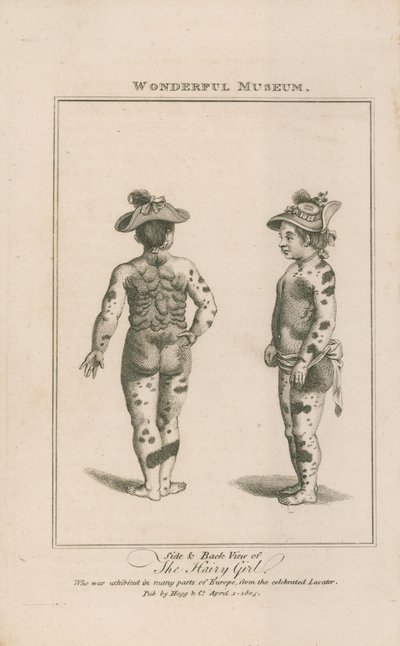 Vue de côté et de dos de la fille velue - English School