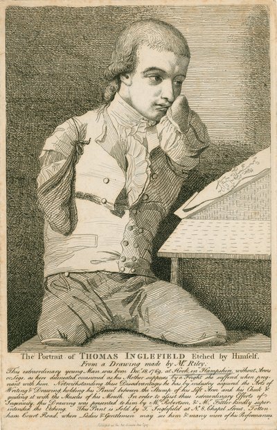 Thomas Inglefield, né le 18 décembre 1769 à Hook, Hampshire, sans bras ni jambes - English School