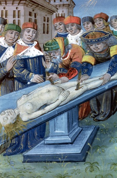 Dissection, de De Medina Fen I. II, par Avicenne - Flemish School