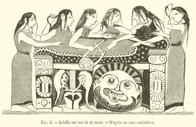 Achille sur son lit de mort - French School