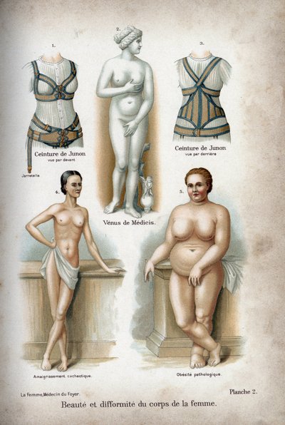 Beauté et déformation du corps de la femme : une femme trop maigre et une obèse représentées en dessous de la Vénus de Médicis, considérée comme la "femme idéale". - French School