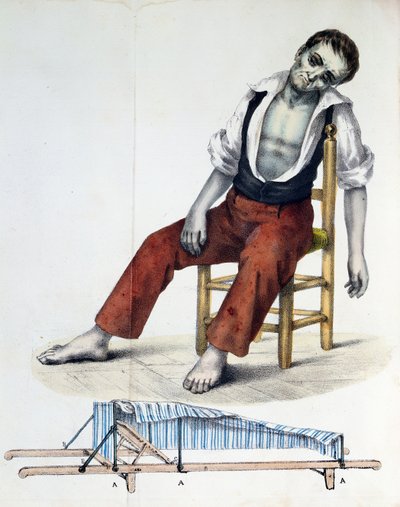 Cholera Morbus, de Relacao, Historica, Statistica e Medica da Cholera-Morbus par Francisco d