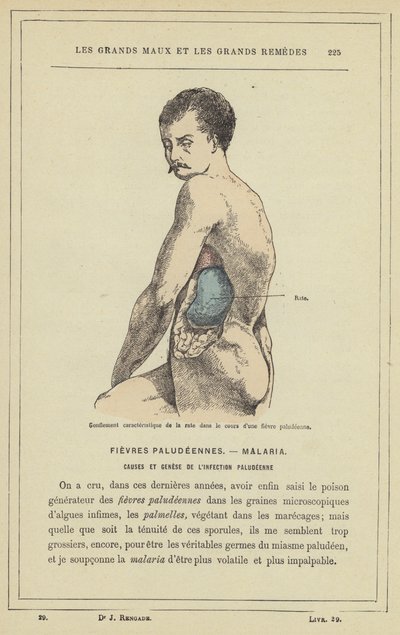 Gonflement caractéristique de la rate dans le cours d