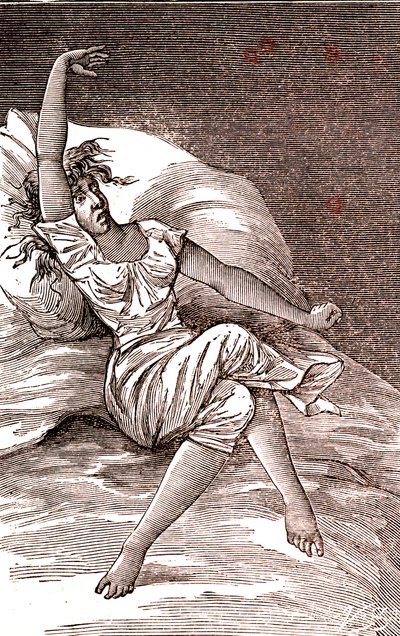 Maux de tête, mélancolie et hystérie, anxiété. 1887 (gravure) - French School