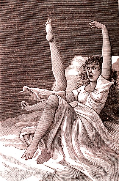 Hystérie, un phénomène mental extrême, psychoses et psychonévroses. 1887 - French School