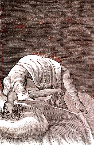 Hystérie, trouble mental et nerveux, résultant d