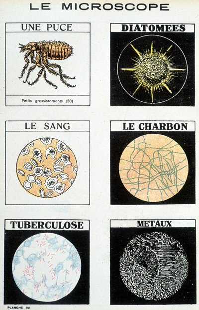 Microscopes : une puce, diatomées, sang, charbon, tuberculose, métaux - French School