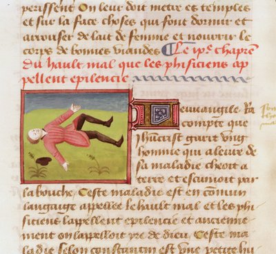 Ms 22532 Patient souffrant d