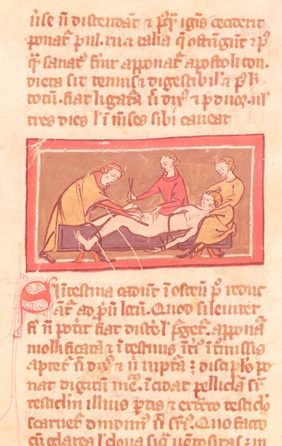 Ms H 89 fol.23 Chirurgie, d