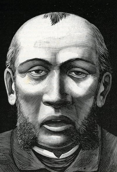 Patient avec ramollissement cérébral (gravure) 1888 - French School