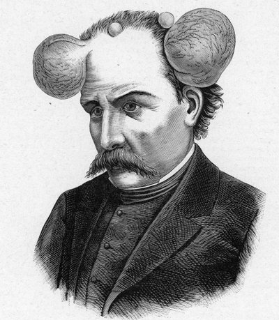 Représentation d