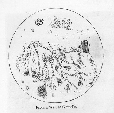 Sédiment de l